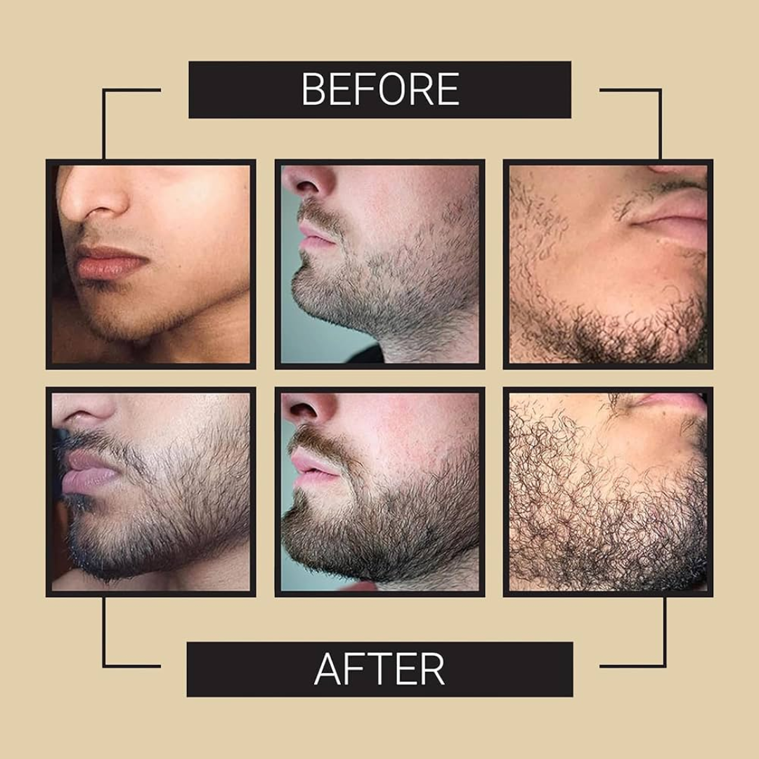 Dr. Alies Professional Beard Growth Oil | Natural Formula with Vitamin E, Almond Oil & Castor Oil