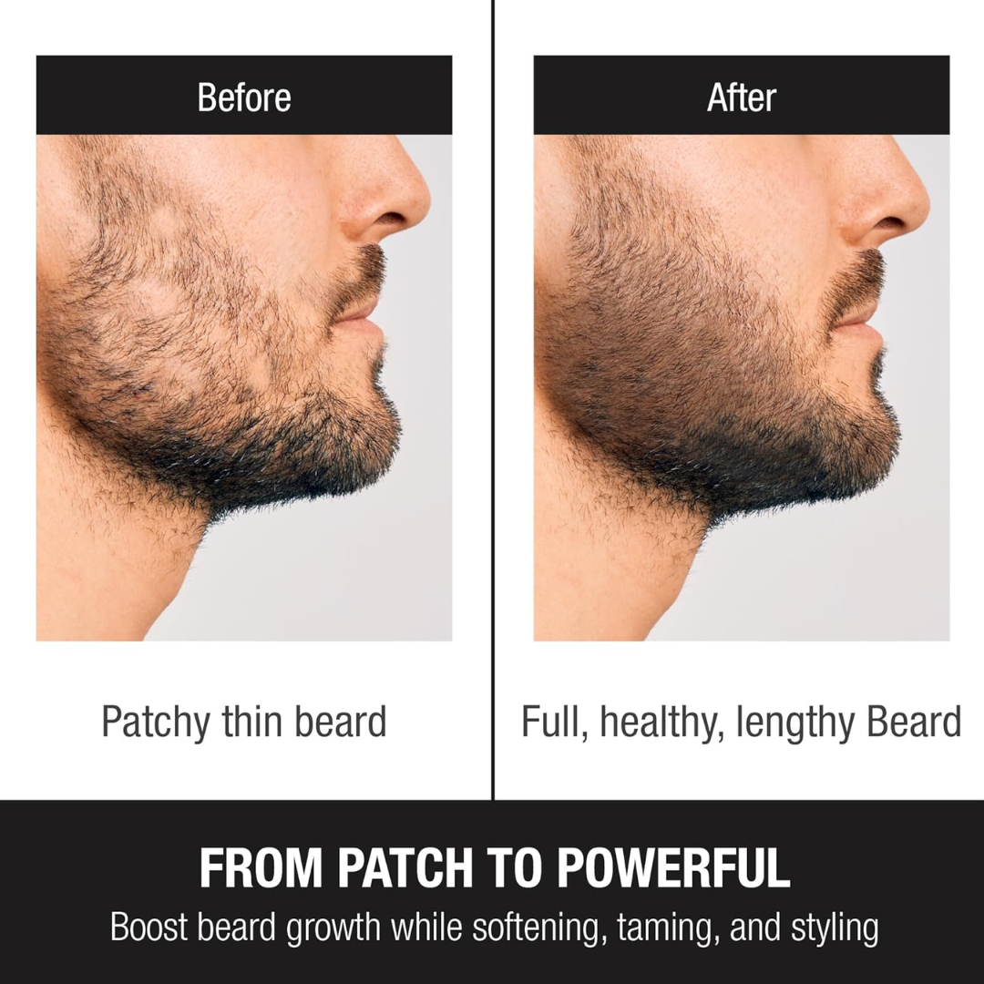 Dr. Alies Professional Beard Growth Oil | Natural Formula with Vitamin E, Almond Oil & Castor Oil