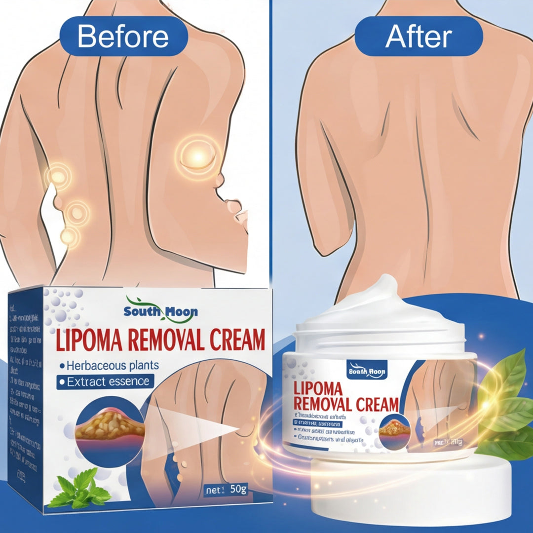 South Moon Lipoma Removal Cream(IMPORTED)