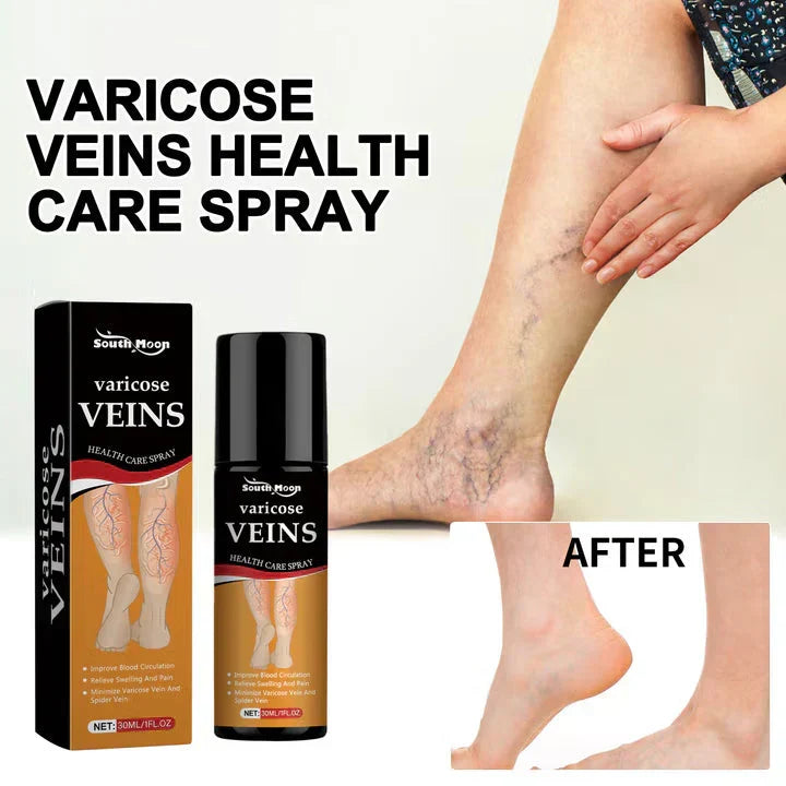 Turmeric Vericose Vein Relief Spray