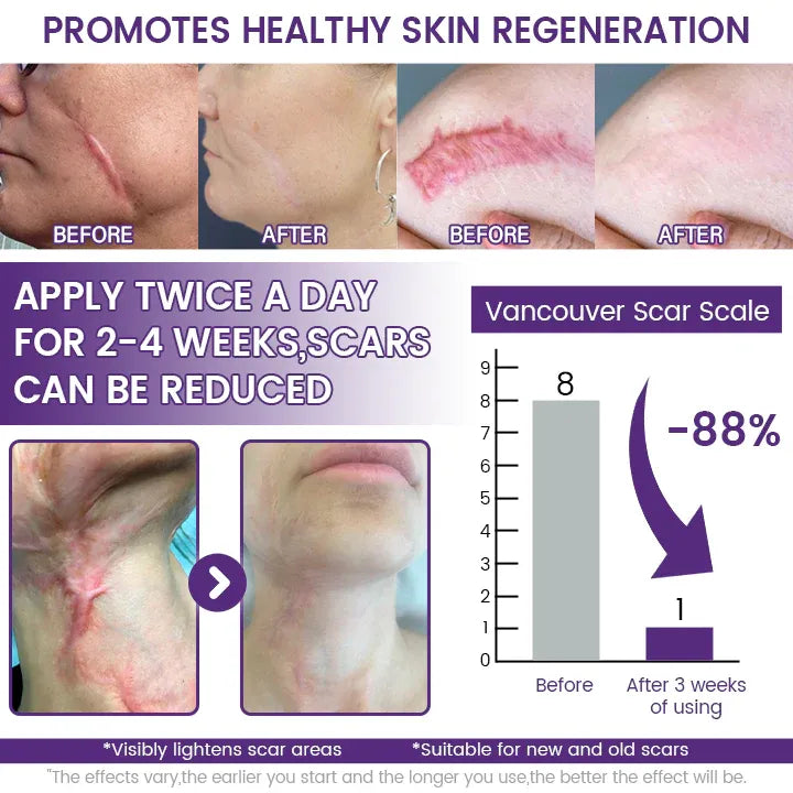 ReGenScar Stem Cell Repair Gel (Visible Scar Improvement in 7 Days)